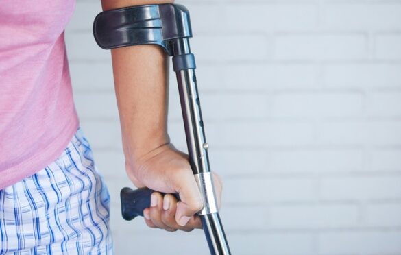 How To Stay Active While Recovering From An Injury